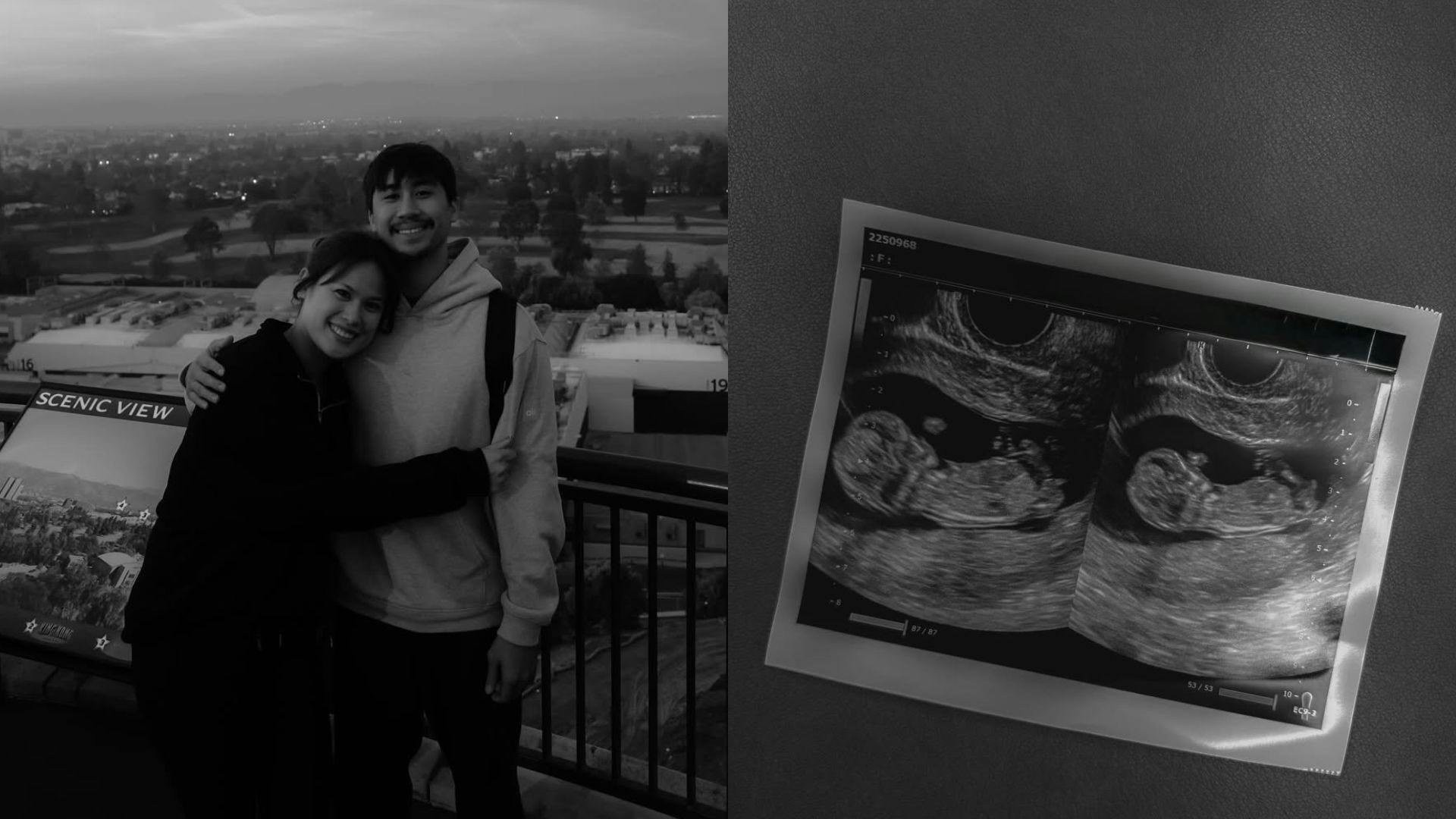 Risa Sato shares pregnancy news with partner Enzo Joson